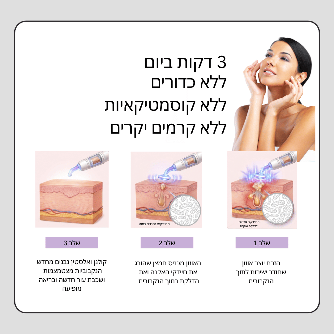 טיפול בתדר גבוה | מעלים אקנה ומונע התפרצויות בעתיד